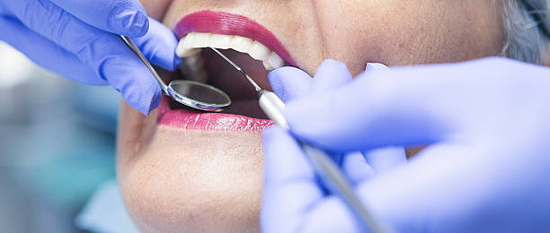 Best Emergency Tooth Extraction in Reminderville, OH